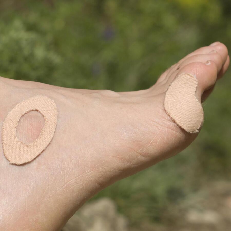 adventure medical kits moleskin kit 4 adventure medical kits moleskin kit